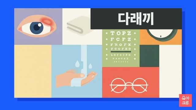 아이 눈다래끼와 콩다래끼 구분과 온찜질 안내