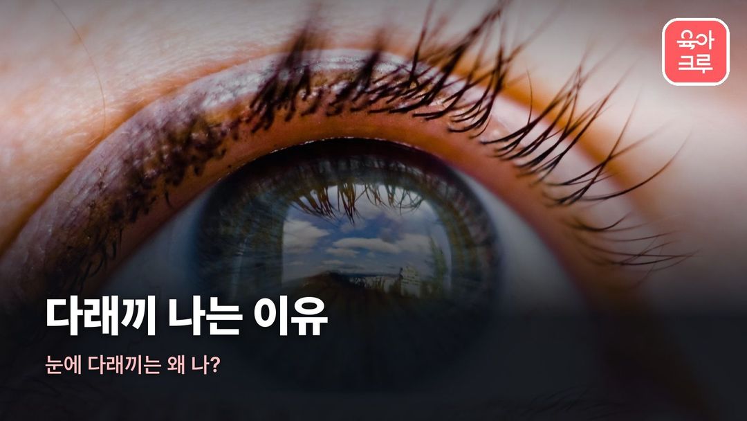 다래끼 나는 이유 커버 사진