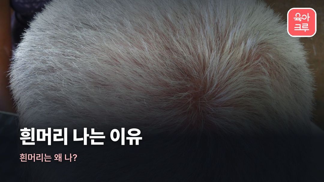 흰머리 나는 이유 커버 사진