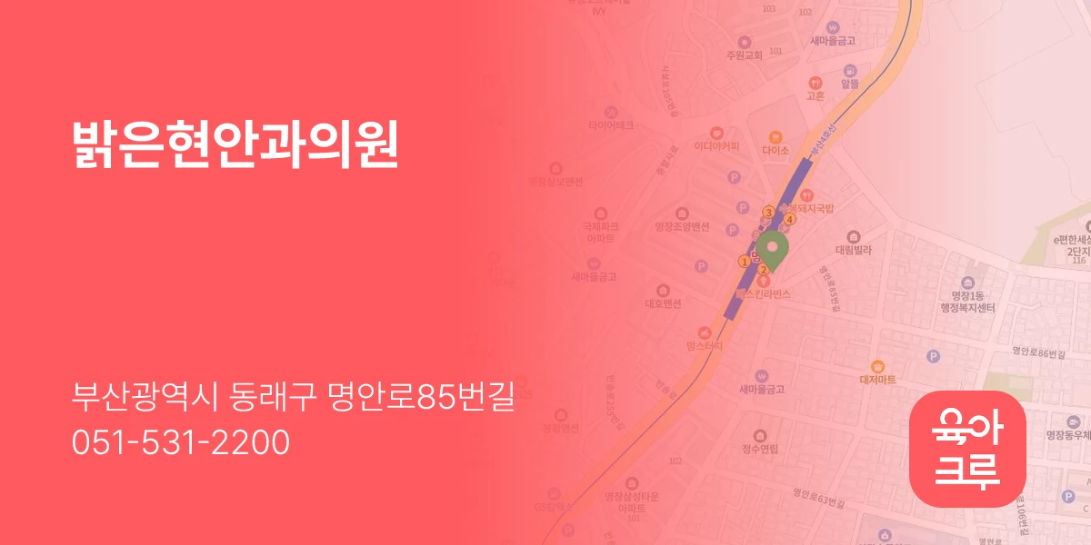 밝은현안과의원